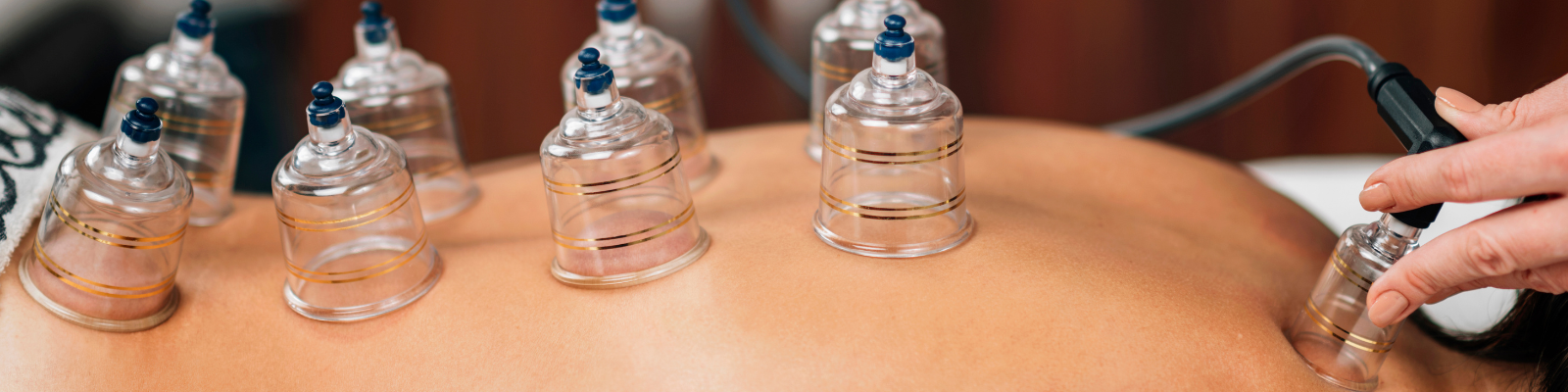 Cupping Therapy Treatment - Be Well Holistic Massage Wellness Center, P.A.